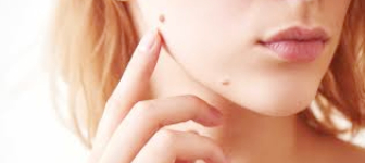 Endoscopic Sinus Surgery Malad